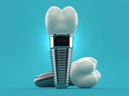 Dental implant components displayed against blue background showing crown, abutment, and screw.